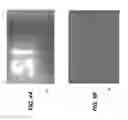 Fig. 04 - Despeckling method for radiographic images