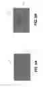 Fig. 05 - Despeckling method for radiographic images