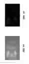 Fig. 11 - Despeckling method for radiographic images