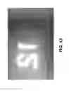 Fig. 12 - Despeckling method for radiographic images