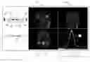Fig. 01 - Method and apparatus for generation of a physiologically-derived map correlated with anatomical image data