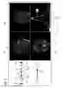 Fig. 03 - Method and apparatus for generation of a physiologically-derived map correlated with anatomical image data