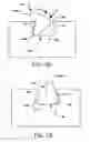 Fig. 08 - Seal for wafer processing assembly