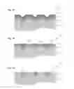 Fig. 04 - Systems and methods for producing flat surfaces in interconnect structures