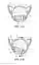 Fig. 12 - Wireless entrance communication device