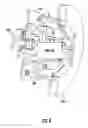 Fig. 04 - Harvester reciprocating drive balancing system