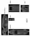 Fig. 05 - METHODS AND MATERIALS FOR USING TRANSGENIC NON-HUMAN ANIMALS EXPRESSING SODIUM IODIDE SYMPORTER POLYPEPTIDES TO MONITOR PATHOLOGICAL PROCESSES, DISEASE PROGRESSION, OR THERAPEUTIC RESPONSES OVER TIME