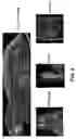 Fig. 06 - METHODS AND MATERIALS FOR USING TRANSGENIC NON-HUMAN ANIMALS EXPRESSING SODIUM IODIDE SYMPORTER POLYPEPTIDES TO MONITOR PATHOLOGICAL PROCESSES, DISEASE PROGRESSION, OR THERAPEUTIC RESPONSES OVER TIME