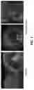 Fig. 07 - METHODS AND MATERIALS FOR USING TRANSGENIC NON-HUMAN ANIMALS EXPRESSING SODIUM IODIDE SYMPORTER POLYPEPTIDES TO MONITOR PATHOLOGICAL PROCESSES, DISEASE PROGRESSION, OR THERAPEUTIC RESPONSES OVER TIME