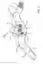 Fig. 04 - Breath-powered vapor distribution device