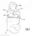 Fig. 03 - INFANT GARMENT