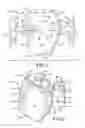 Fig. 02 - Protective device for use with a glove