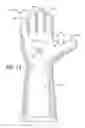 Fig. 08 - Protective device for use with a glove