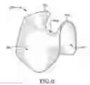 Fig. 03 - Protective device for use with a glove