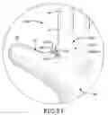 Fig. 19 - Protective device for use with a glove