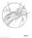 Fig. 07 - Twin Loop Hair Extension