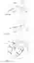 Fig. 10 - Wearable smart band