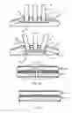 Fig. 06 - Oral cleaning device with adjustable shape and oral cleaning method