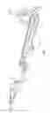 Fig. 03 - Mechanical extending linkage and seating unit comprising the same