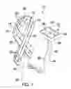 Fig. 02 - Light Emitting Ornament Assembly
