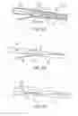 Fig. 09 - Physiological sensor delivery device and method