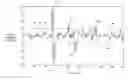 Fig. 01 - Cardiac potential detection device and cardiac potential detection method