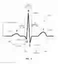 Fig. 04 - Systems and methods for guidance and placement of an intravascular device