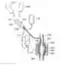 Fig. 01 - Device for treatment of aneurysm