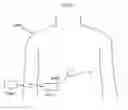 Fig. 07 - Device for treatment of aneurysm