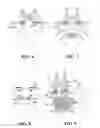 Fig. 04 - Selecting triggers of an allergic reaction based on nasal temperatures