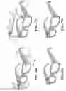 Fig. 07 - Selecting triggers of an allergic reaction based on nasal temperatures