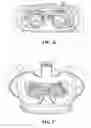 Fig. 13 - Selecting triggers of an allergic reaction based on nasal temperatures