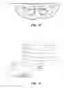 Fig. 14 - Selecting triggers of an allergic reaction based on nasal temperatures