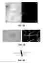 Fig. 16 - Thresholding methods for lesion segmentation in dermoscopy images