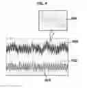 Fig. 04 - Method for detecting abnormal respiration using a photoplethysmography (PPG) signal