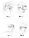 Fig. 03 - Clip-on device with inward-facing cameras