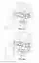 Fig. 02 - Calculating respiratory parameters from thermal measurements
