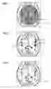 Fig. 02 - Providing corrected x-ray images
