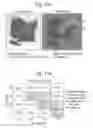 Fig. 13 - Tissue analysis by mass spectrometry or ion mobility spectrometry