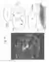 Fig. 19 - Tissue analysis by mass spectrometry or ion mobility spectrometry