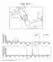 Fig. 48 - Tissue analysis by mass spectrometry or ion mobility spectrometry