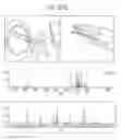 Fig. 49 - Tissue analysis by mass spectrometry or ion mobility spectrometry