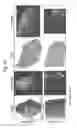 Fig. 60 - Tissue analysis by mass spectrometry or ion mobility spectrometry