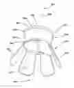 Fig. 01 - Surgical access device comprising internal retractor