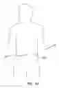 Fig. 02 - Surgical access device comprising internal retractor