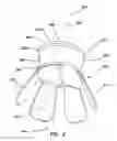 Fig. 06 - Surgical access device comprising internal retractor
