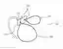 Fig. 01 - Method of passing suture tails through a surgical pledget
