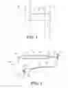 Fig. 02 - Adjustable implants and methods of implanting the same