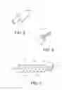 Fig. 04 - Adjustable implants and methods of implanting the same