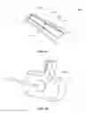 Fig. 09 - DEVICE FOR TENSIONING A SUTURE